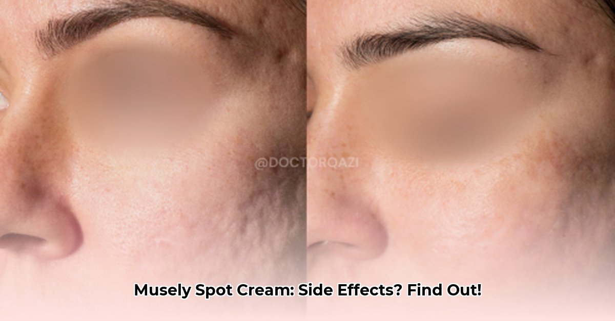 musely-spot-cream-side-effects